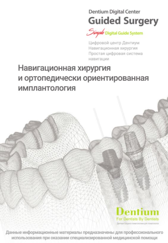 Навигационная хирургия