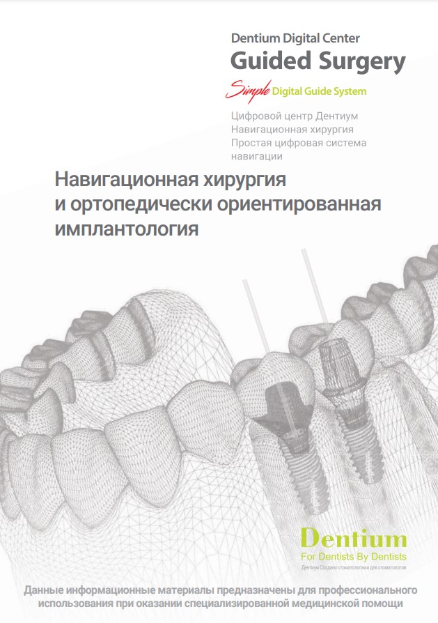 Навигационная хирургия